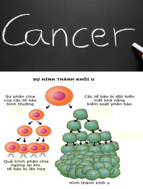 Những quan niệm sai về ung thư là gì?