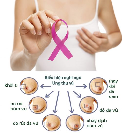 Những quan niệm sai về ung thư vú