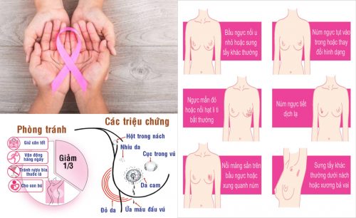 Cách phòng tránh ung thư vú
