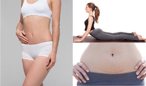 Bài tập làm giảm mỡ bụng cho phụ nữ sau sinh mổ