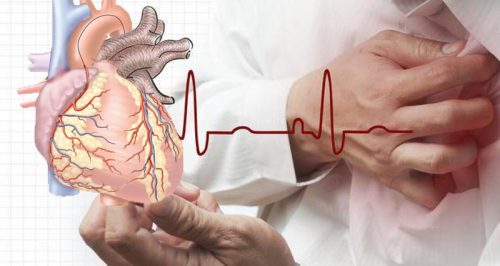 Bệnh tim mạch là gì?