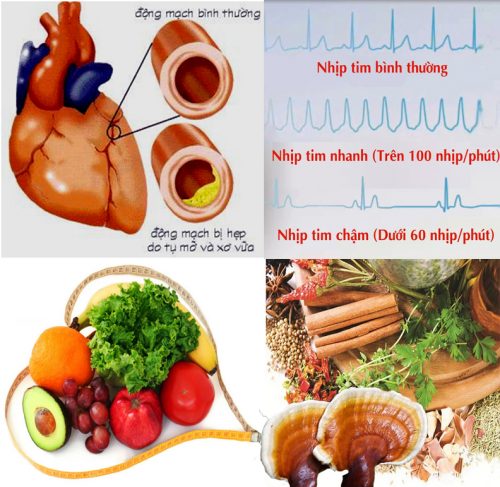 Bệnh tim mạch với nguyên nhân dấu hiệu và cách chữa bệnh tim mạch