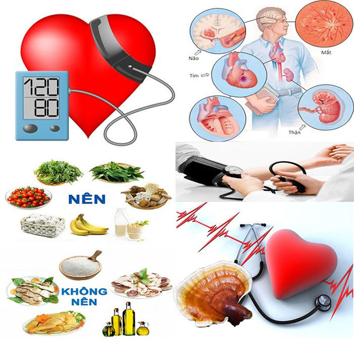 Huyết áp cao cùng nguyên nhân biểu hiện và cách điều trị hiệu quả