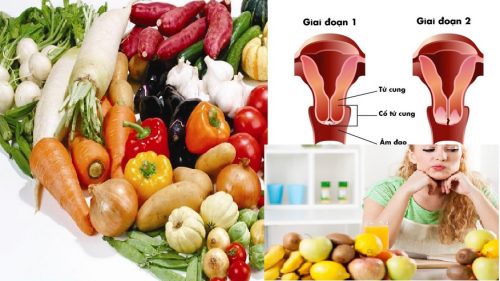 Thực phẩm phòng ngừa ung thư cổ tử cung
