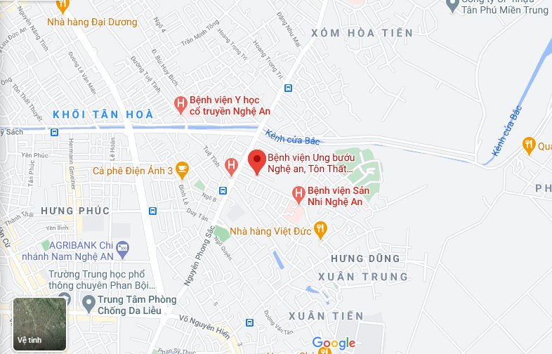 Bệnh viện ung bướu Nghệ An ở đâu và các tuyến xe đi qua bệnh viện
