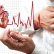 Bệnh tim mạch vành với nguyên nhân triệu chứng bệnh tim mạch vành