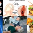 Đột quỵ não với triệu chứng và thực đơn điều trị đột quỵ não tái phát