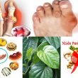 Bệnh gout với nguyên nhân triệu chứng và lưu ý cách chữa bệnh gout