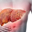 Bệnh xơ gan có điều trị được không cách chẩn đoán điều trị xơ gan
