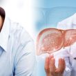 Bệnh xơ gan có điều trị được không và xơ gan có nguy hiểm không?