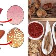 Cách điều trị gan nhiễm mỡ độ 1 2 3 với Đông y và Tây y hiệu quả