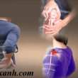 Cảnh báo về chứng đau nhức xương khớp ở người trẻ