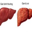 Cao xạ đen có tác dụng gì cho sức khỏe? Lưu ý khi dùng cao xạ đen