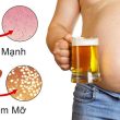 Siêu âm mắc gan nhiễm mỡ không nên quá lo lắng