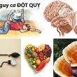 Giảm nguy cơ đột quỵ cùng cách giảm nguy cơ đột quỵ hiệu quả