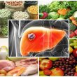 Ung thư gan ăn gì với thực phẩm và chăm sóc người bệnh ung thư gan